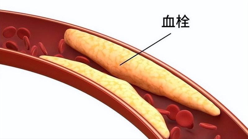 血型不是命运的判决书,而是身体在轻声告诉你什么 健康养生