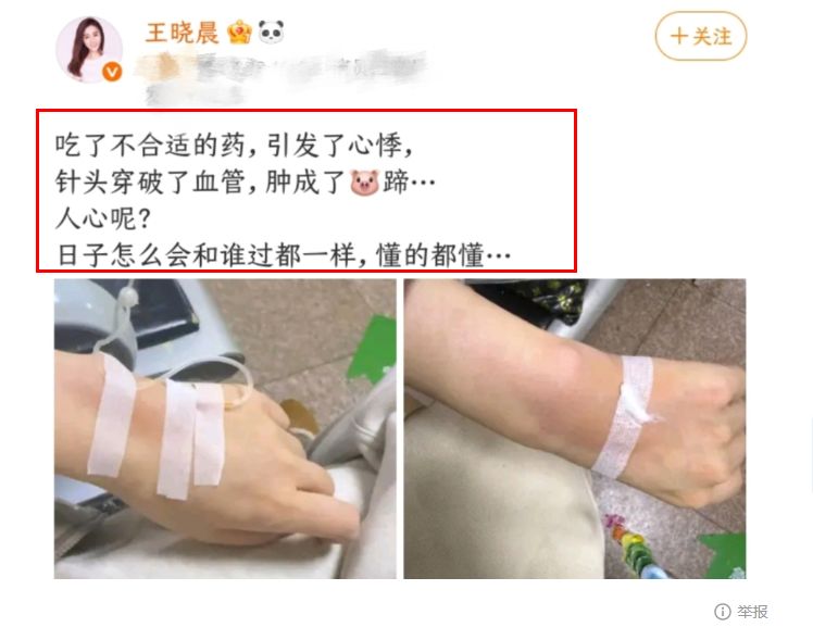  从高调求婚到沉默否认：俞灏明与王晓晨的五年感情博弈深度复盘 娱乐新闻
