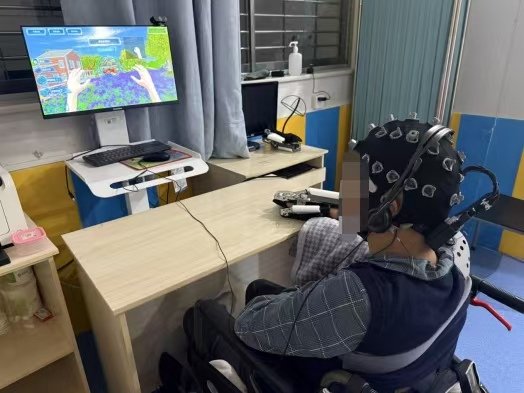当意念成为力量:一个家庭的重生与脑机接口康复门诊的温度 健康养生